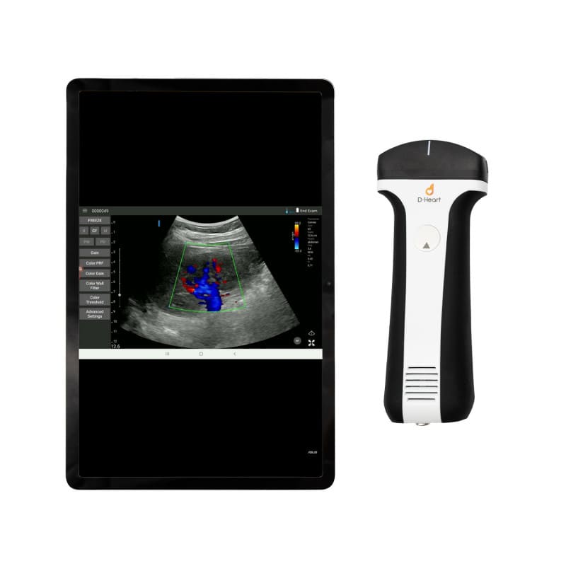 D-Heart mobiler Ultraschall - Anwendung in der Kardiologie mit klarem Display - Med-Praxisbedarf