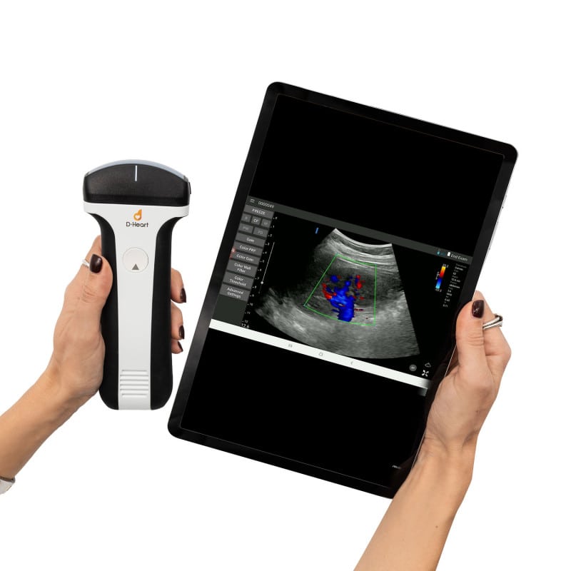 D-Heart Handgerät für Ultraschall - Detailaufnahme des Schallkopfes und der Schnittstelle - Med-Praxisbedarf