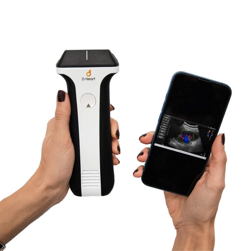 D-Heart Bedienoberfläche - intuitive Touchscreen-Steuerung des Ultraschallgeräts - Med-Praxisbedarf