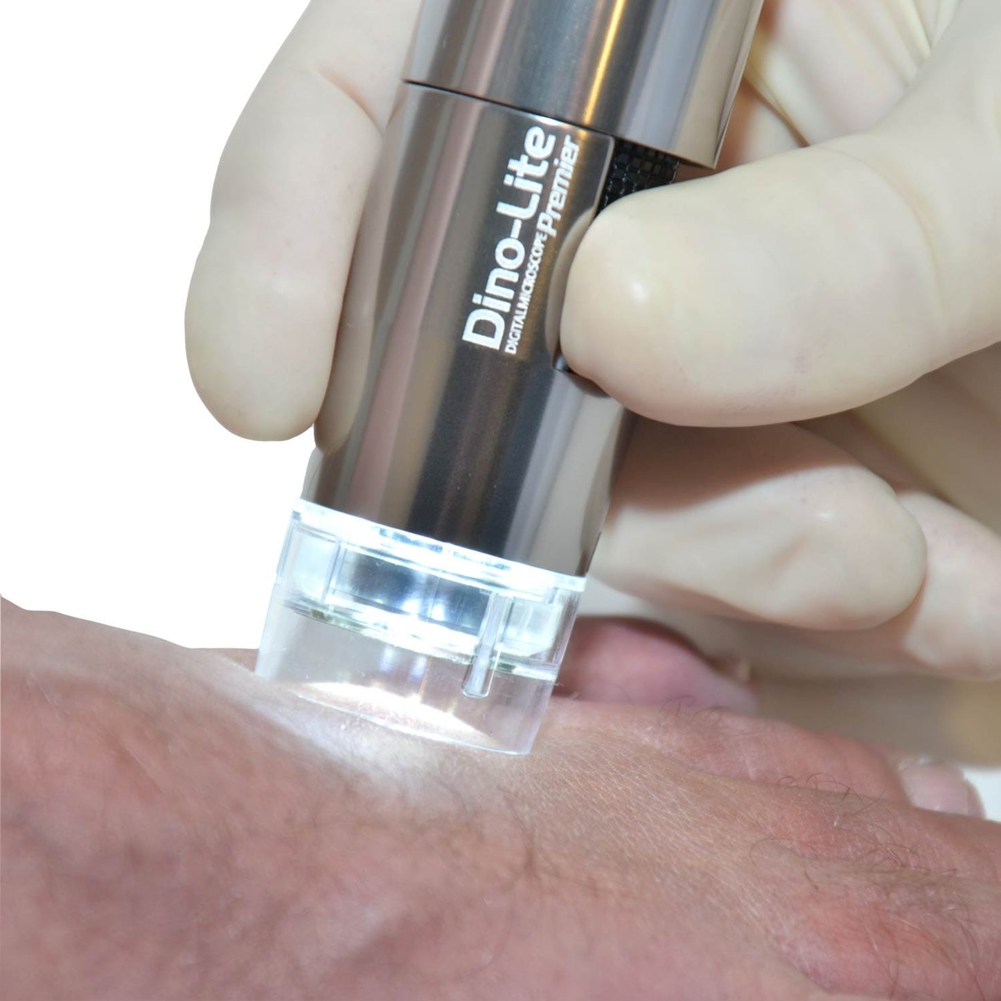 PodoScope von Dino-Lite in der Podologie - Detailaufnahmen von Füßen, USB-Anschluss - Med-Praxisbedarf