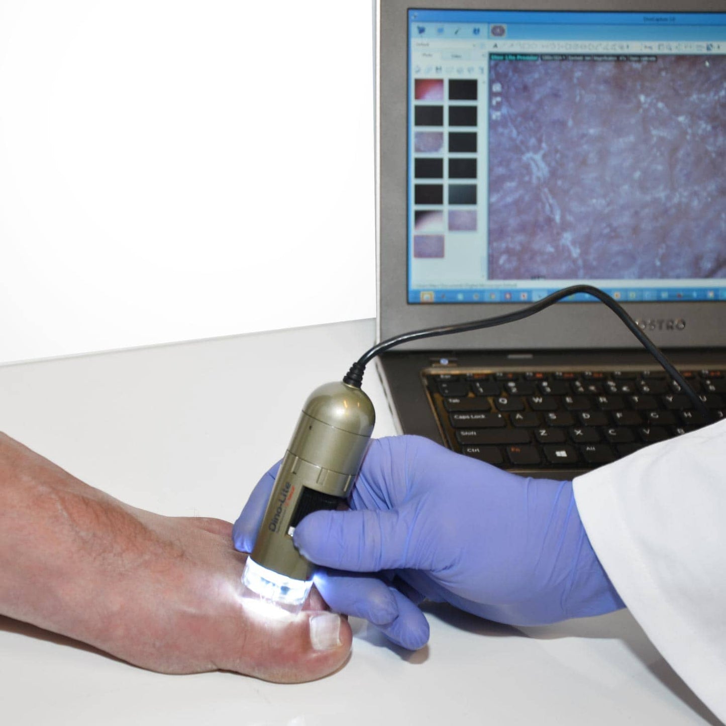 Digitales Dino-Lite PodoScope im Einsatz - für präzise Fußdiagnostik in der Praxis - Med-Praxisbedarf