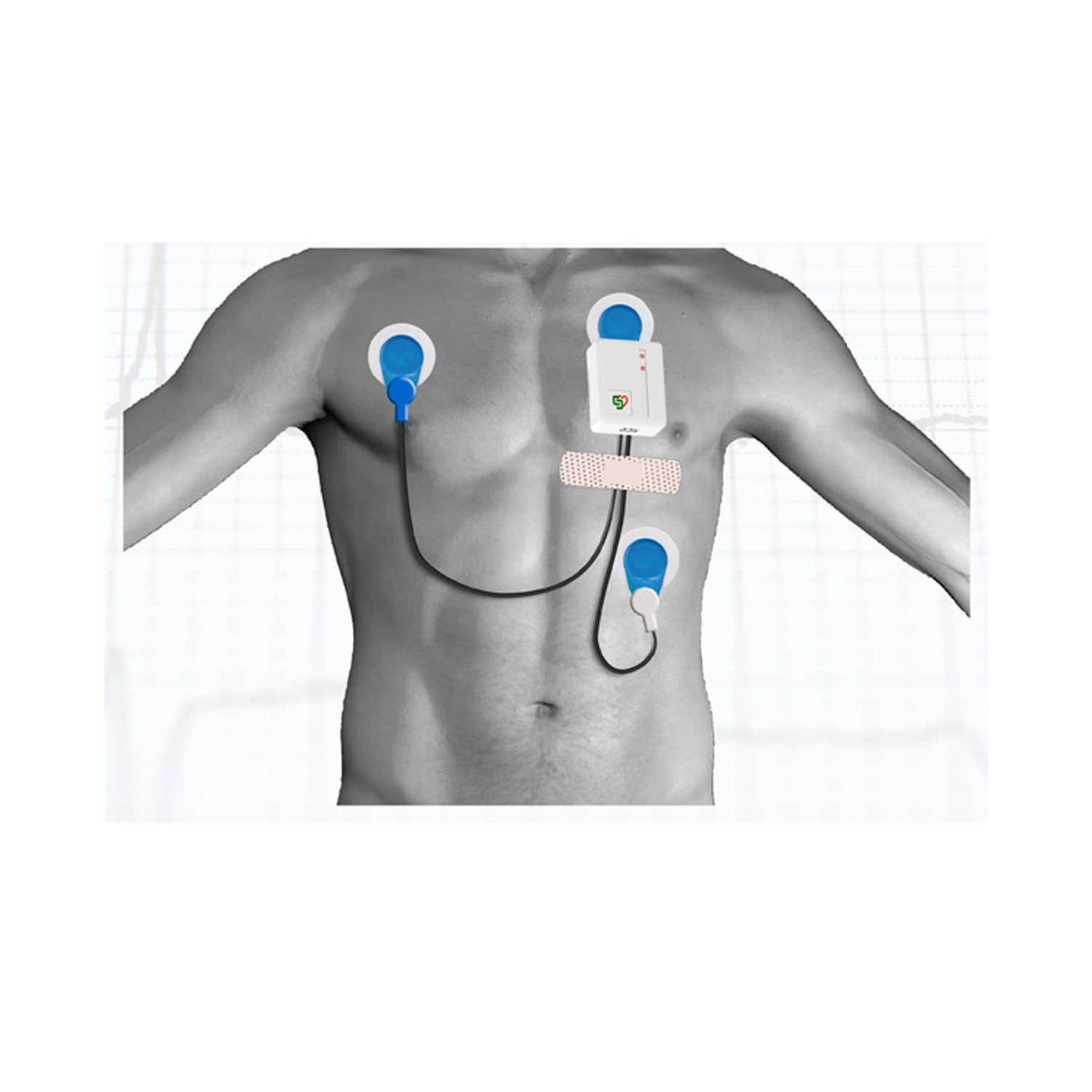 Zusatzrekorder für Kobold II EKG-System - Gerät von Dr. Gerhard Schmidt - Med-Praxisbedarf