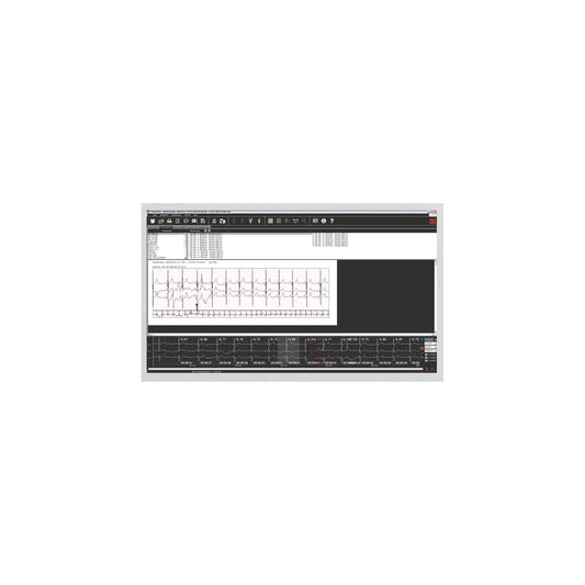 SmartHolter24 Holter-EKG-Gerät - kompaktes 3-Kanal-Gerät für Langzeitaufzeichnung - Med-Praxisbedarf