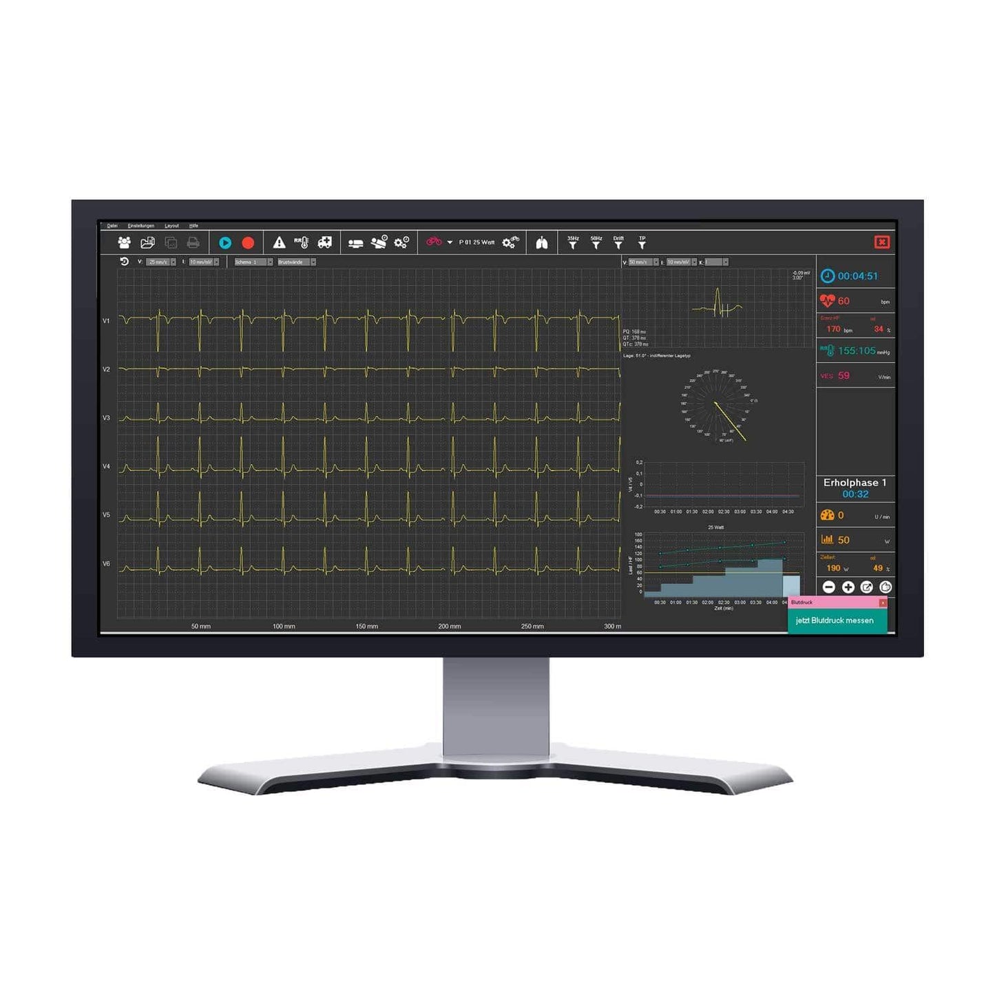 SmartScript Ergometrie mit PC-Monitor - Darstellung von EKG-Kurven und Analyse-Software - Med-Praxisbedarf