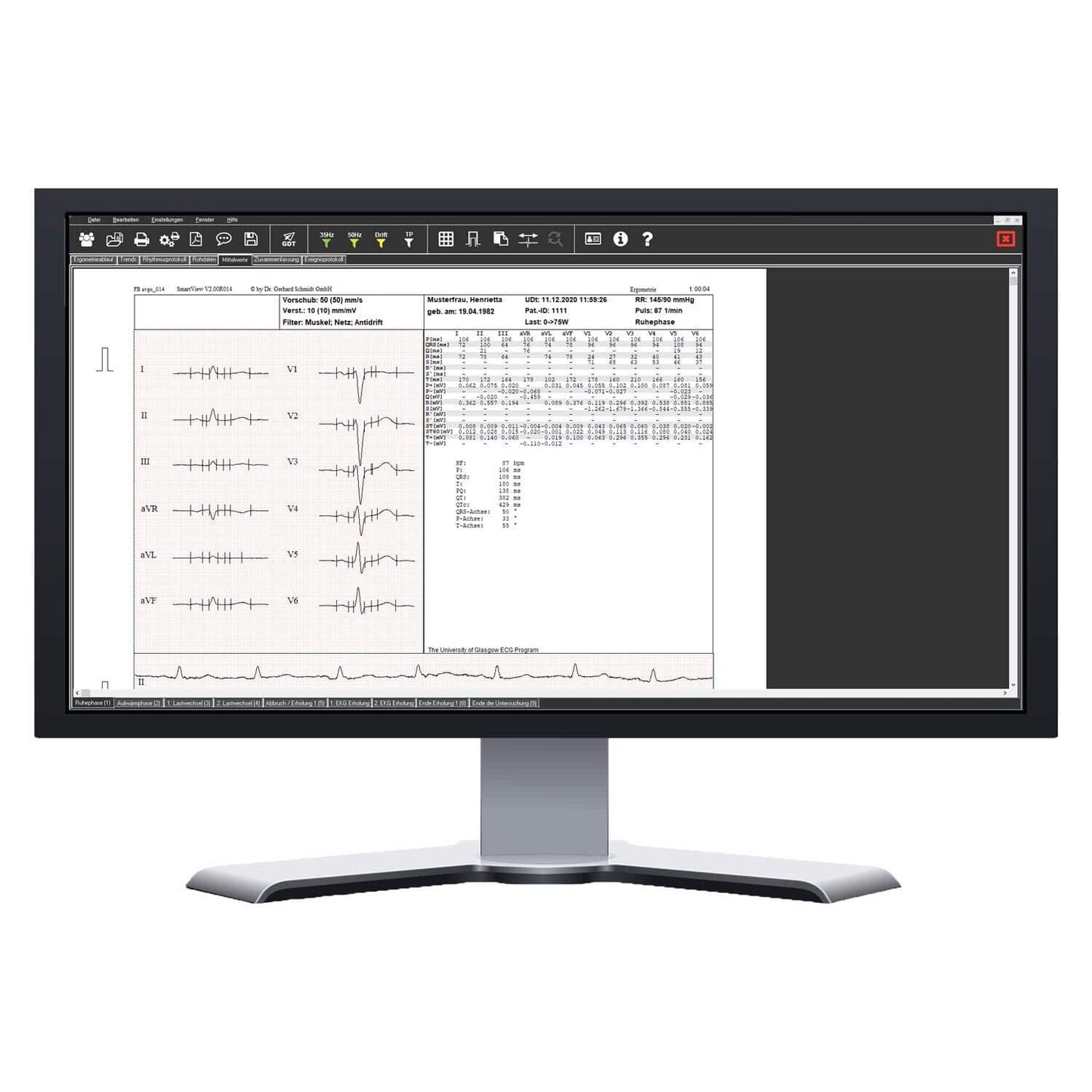 SmartScript Ergometrie Gerät Seitenansicht - kompaktes Design für den Praxisalltag - Med-Praxisbedarf