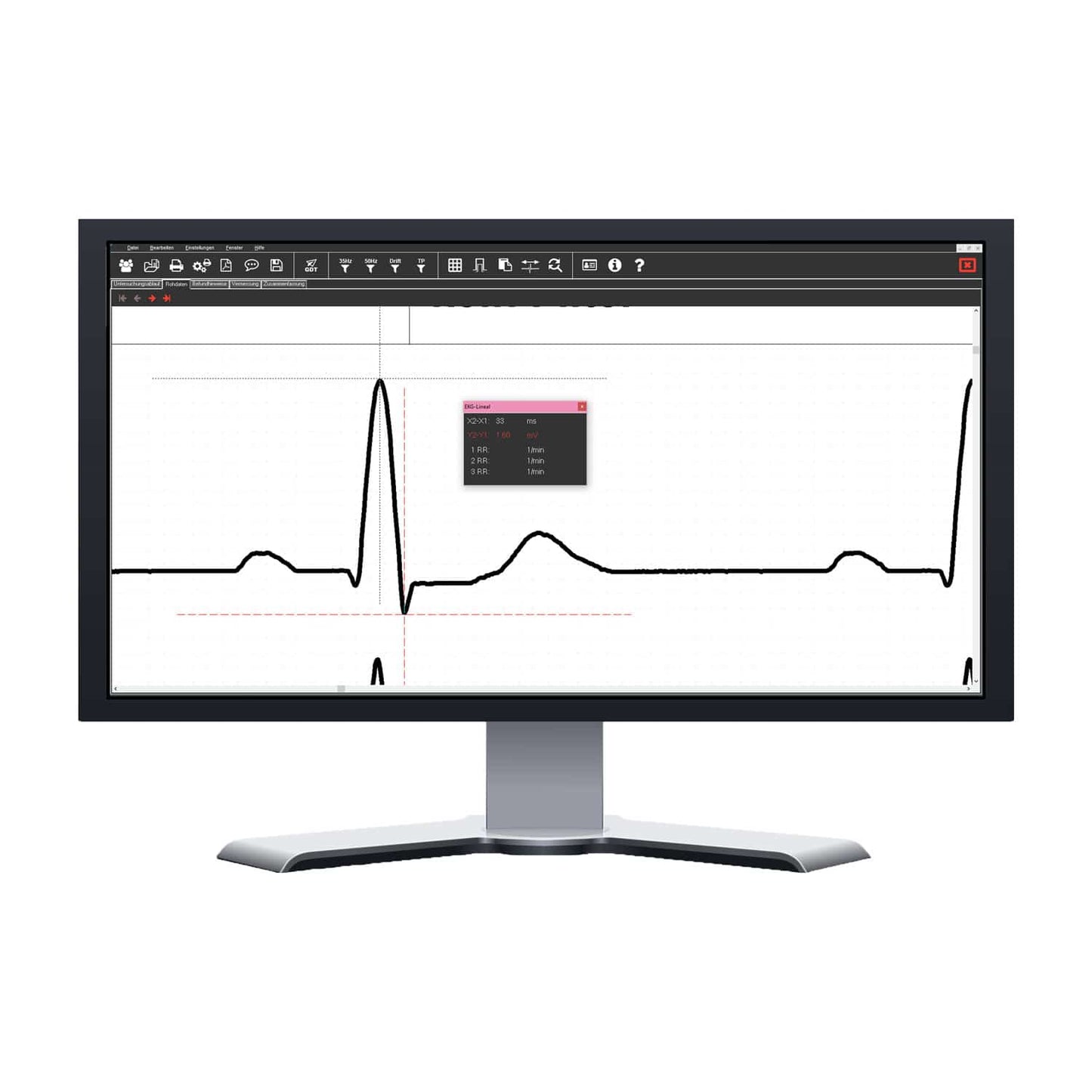 EKG-System SmartScript PC - für die Praxis mit umfangreicher Datenarchivierung - Med-Praxisbedarf