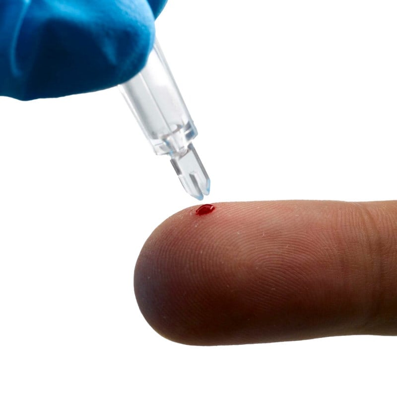 EKF Blutkollektoren für kapillare Blutentnahme - geeignet für Quo-Test, Mikrocontainer - Med-Praxisbedarf