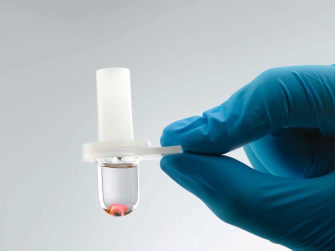 Quo-Test Kontroll-Kit für A1c Messgerät - Funktionsprüfung für Arztpraxen und Kliniken - Med-Praxisbedarf