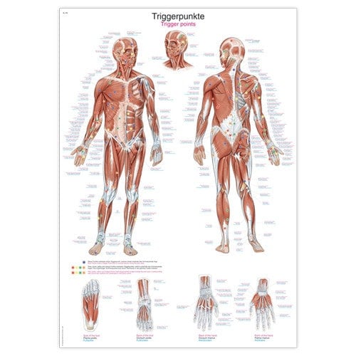 Lehrtafel Triggerpunkte Anatomie - detaillierte Darstellung für Patientenschulung - Med-Praxisbedarf