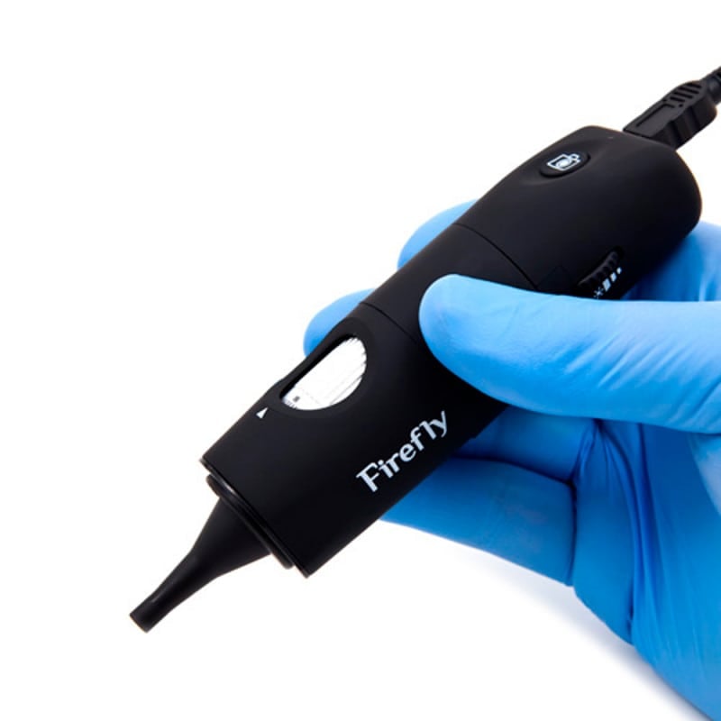 Firefly Video-Otoskop für PC - hochauflösende Untersuchung von Gehörgang und Trommelfell - Med-Praxisbedarf