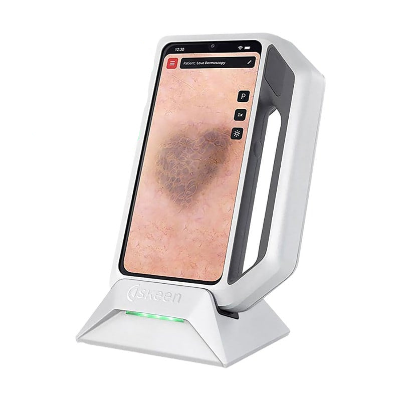 FotoFinder Trichoscopy Lizenz - Software zur Diagnostik von Haar- und Kopfhauterkrankungen - Med-Praxisbedarf