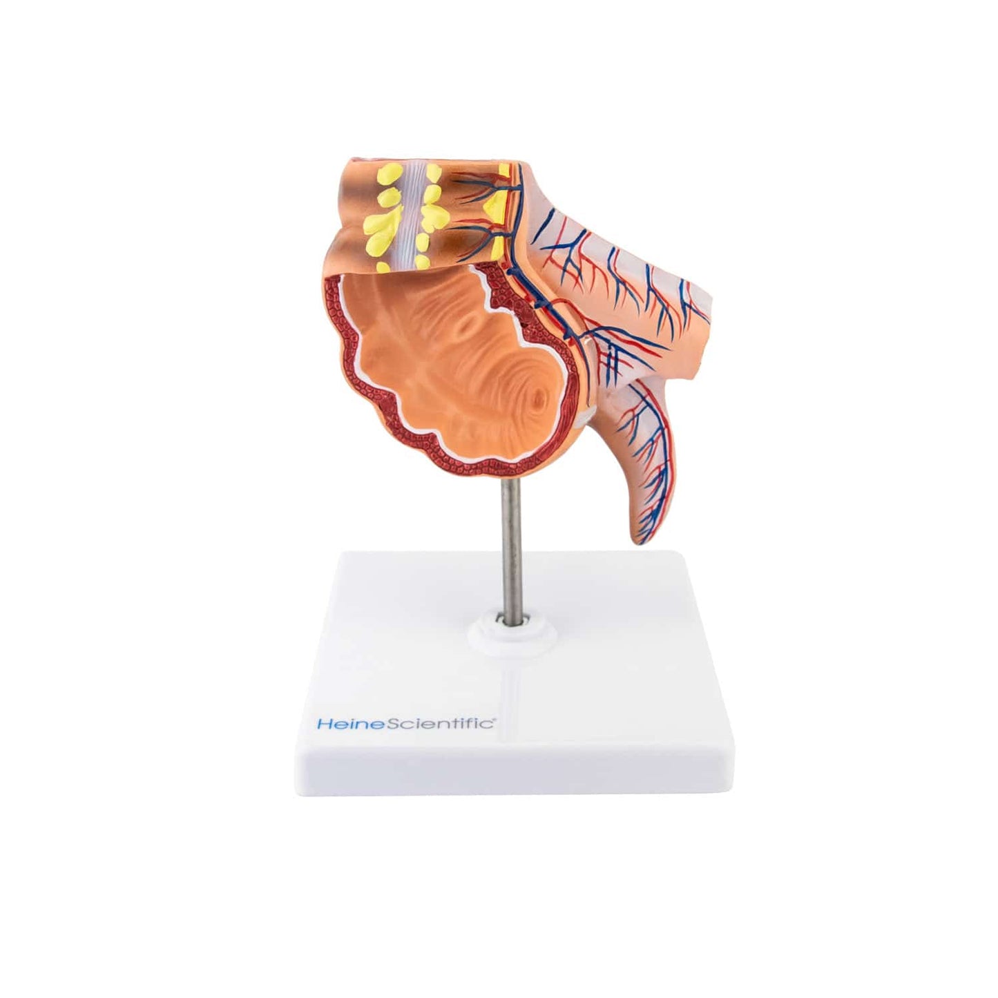 Anatomisches Modell des Blinddarms - detaillierte Darstellung der Strukturen für die Ausbildung - Med-Praxisbedarf