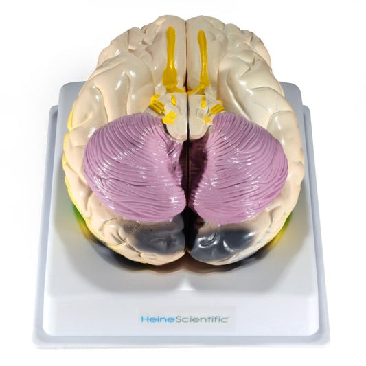 Gehirnmodell mit Funktionsbereichen - Anschauliches Anatomiemodell von HeineScientific, zweiteilig - Med-Praxisbedarf