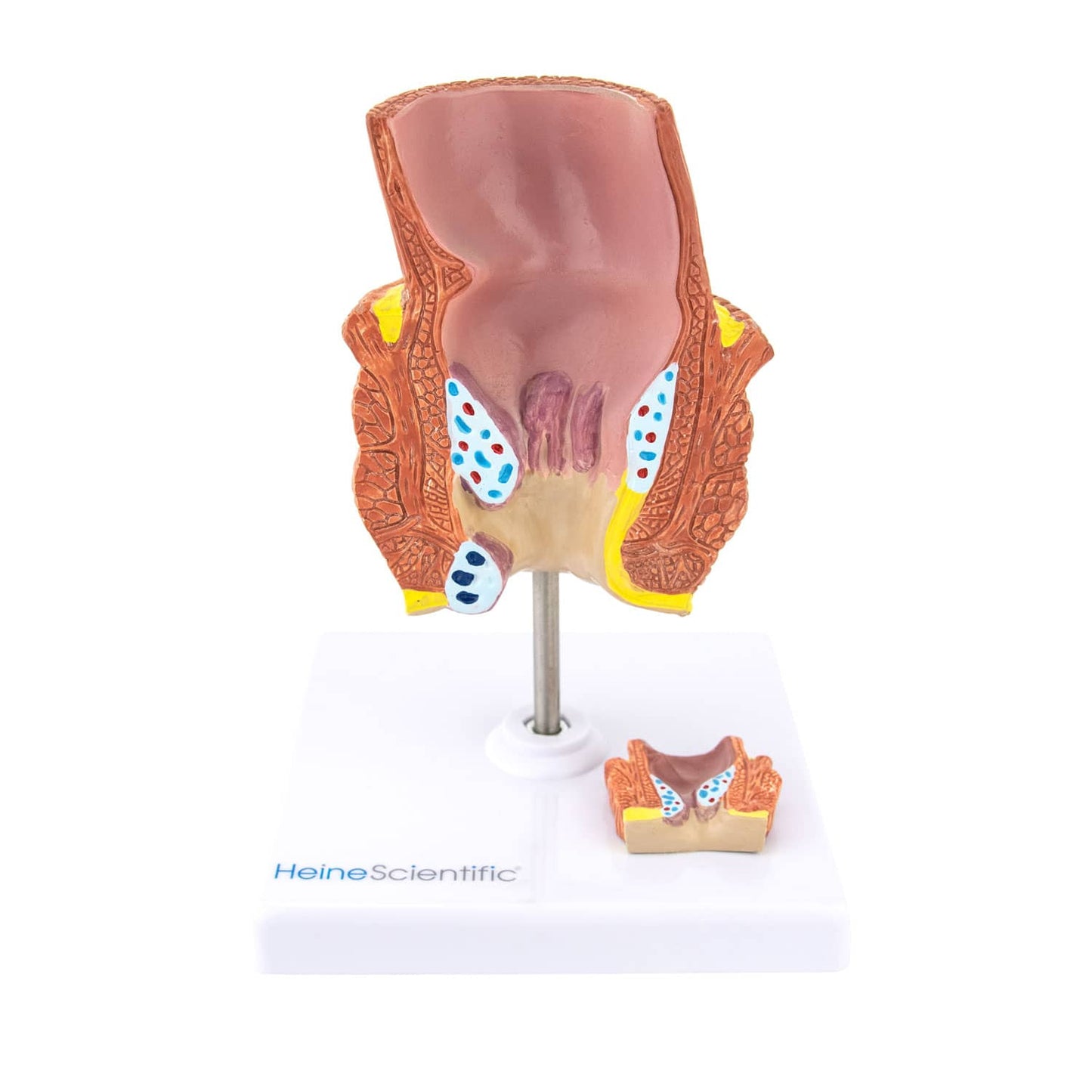 Hämorrhoiden-Modell Detailansicht - vergrößerte Pathologie für Schulung und Aufklärung - Med-Praxisbedarf