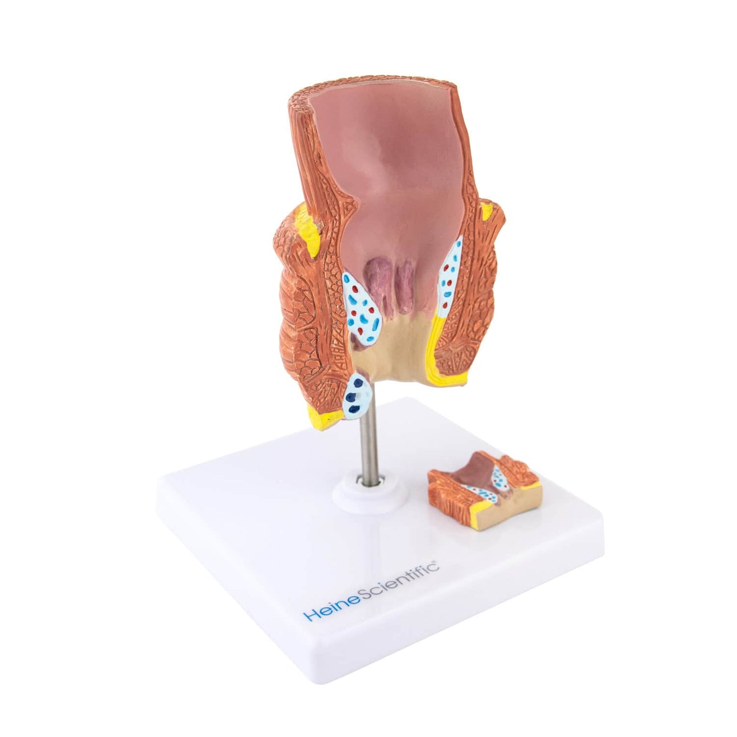 Hämorrhoiden-Modell von der Seite - realistische Nachbildung für medizinische Ausbildung - HeineScientific - Med-Praxisbedarf