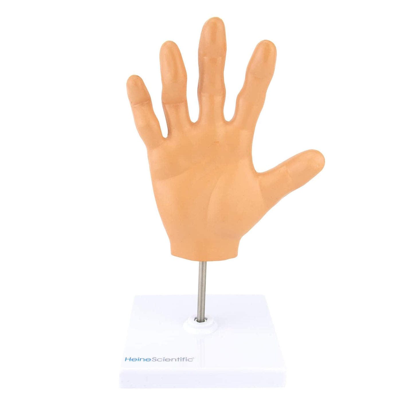 Handmodell rheumatoide Arthritis - anatomische Darstellung von Gelenkveränderungen, HeineScientific - Med-Praxisbedarf
