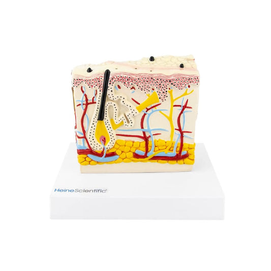 Hautmodell mit Psoriasis - anatomisches Blockmodell zeigt Psoriasis-Hautveränderungen - HeineScientific - Med-Praxisbedarf