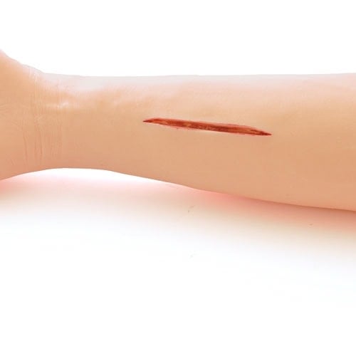 Hautnaht-Trainer Arm im Detail - zeigt realistische Hauttextur und Wundränder - Med-Praxisbedarf