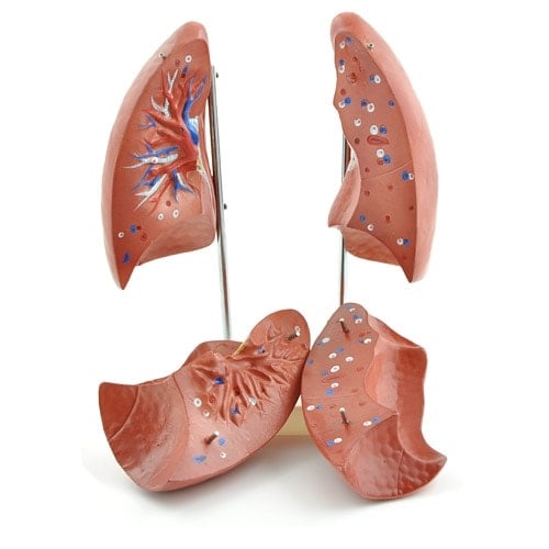Lungenmodell Detailansicht der Bronchien - anatomisches Modell zur Veranschaulichung der Atemwege - Med-Praxisbedarf