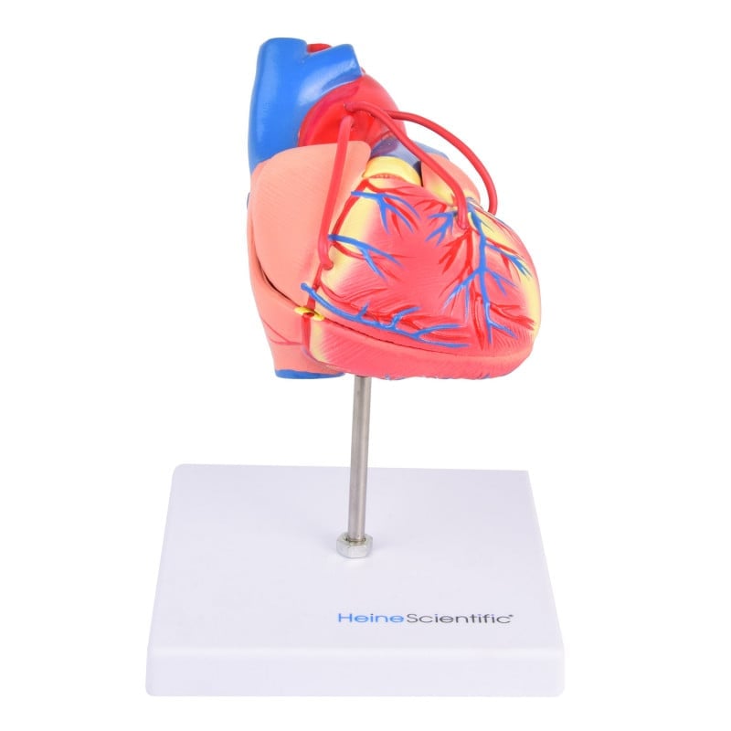 Herzmodell mit Bypass-Operation - zerlegbar, 2-teilig, anatomischer Aufbau - Med-Praxisbedarf