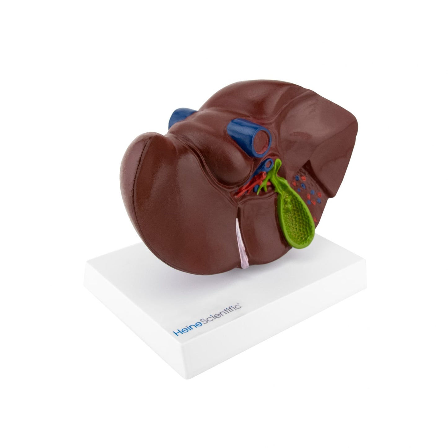 Leber und Gallenblase Modell mit Gallenstein - anatomische Strukturen auf Kunststoffsockel - Med-Praxisbedarf