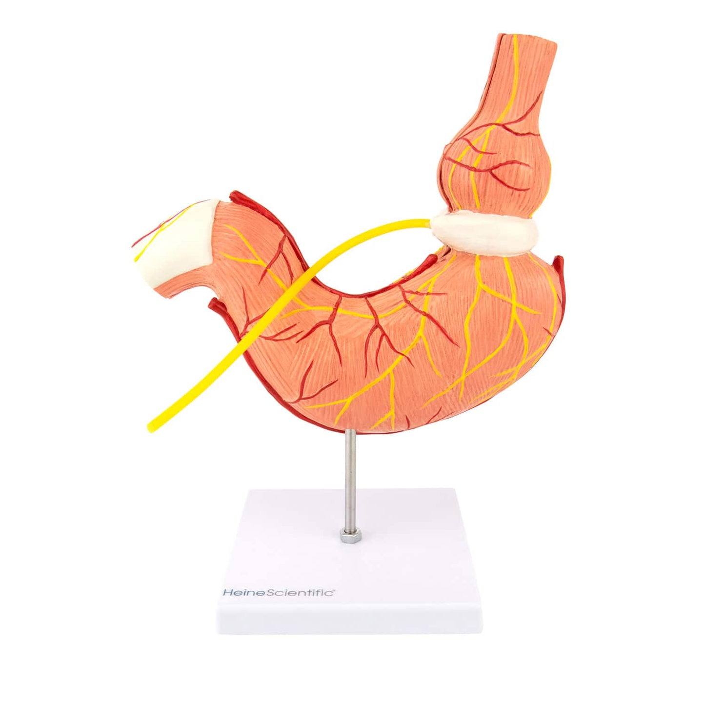 Anatomisches Magenmodell mit Magenband - stabile Präsentation auf Sockel - Med-Praxisbedarf