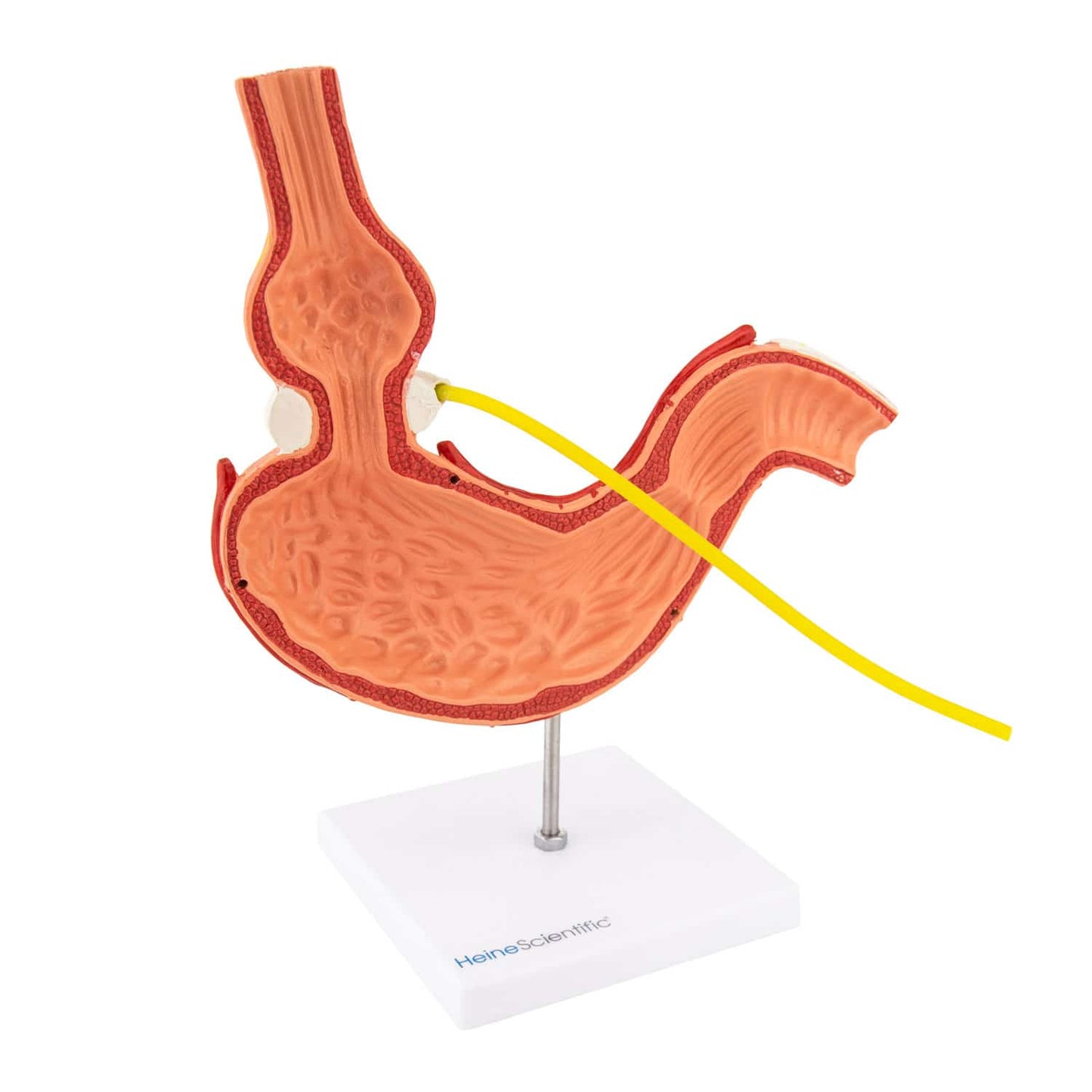 Modell Magen mit Magenband - anatomisches Demonstrationsmodell nach OP auf Stativ - Med-Praxisbedarf