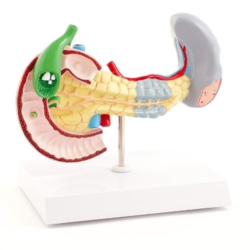 Modell Bauchspeicheldrüse Milz Gallenblase - anatomische Darstellung mit Erkrankungen - Med-Praxisbedarf
