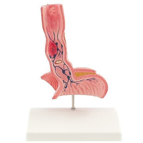 Speiseröhren-Modell Frontalschnitt - Anatomisches Anschauungsmodell für Klinik und Praxis - Med-Praxisbedarf