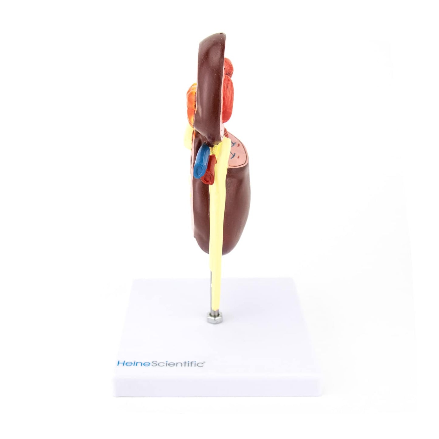 Anatomisches Nierenmodell mit Krankheiten - Lehr- und Anschauungsmodell von HeineScientific für die Medizinerausbildung - ...