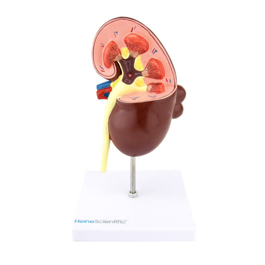 Nierenmodell mit Erkrankungen - Doppelseitiges Schnittmodell zeigt physiologische und pathologische Strukturen - Med-Praxi...