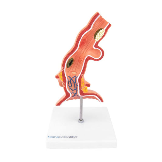 Ösophagus-Modell mit Erkrankungen - unterer Abschnitt der Speiseröhre, anatomisches Lehrmodell - Med-Praxisbedarf