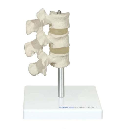 Osteoporose Modell Wirbelsäule - drei median geschnittene Wirbel mit Bandscheiben, Knochenabbau - Med-Praxisbedarf
