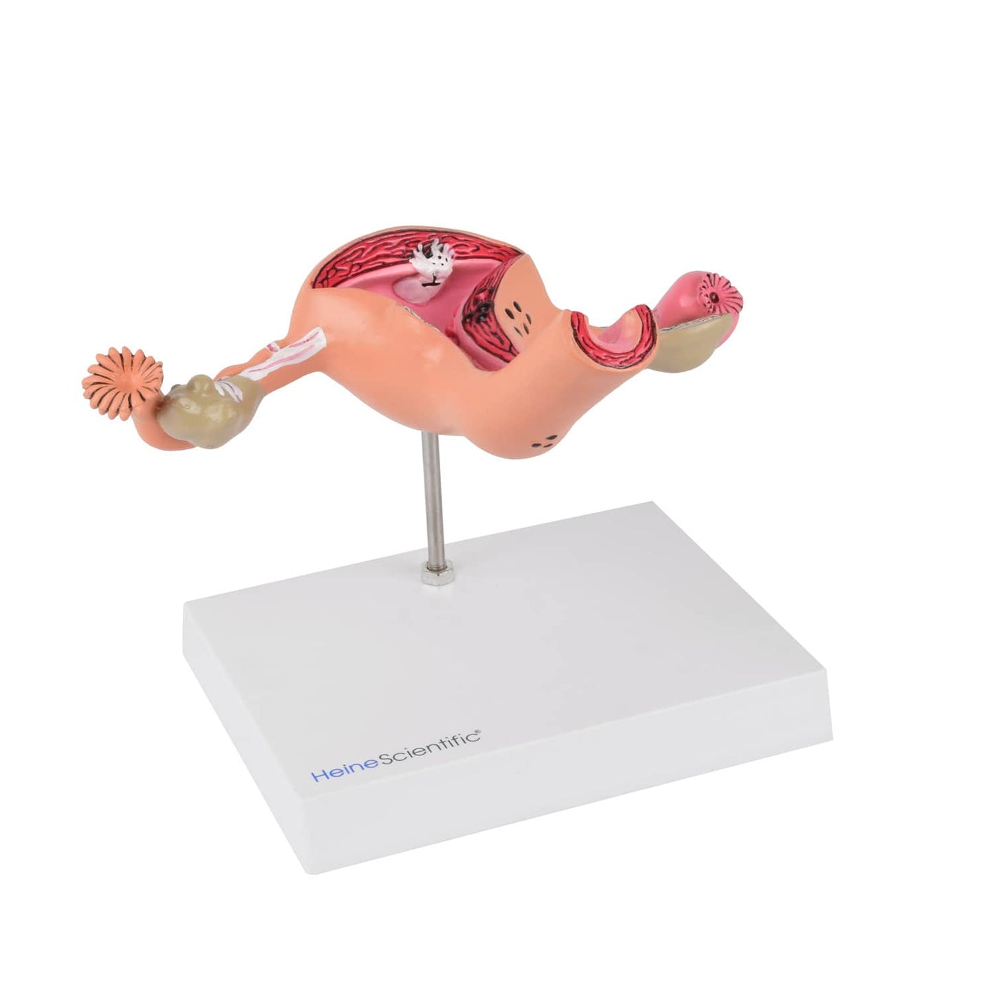 Uterus-Modell mit Erkrankungen - detaillierte Darstellung von Gebärmutter und umliegenden Strukturen in Originalgröße - Me...