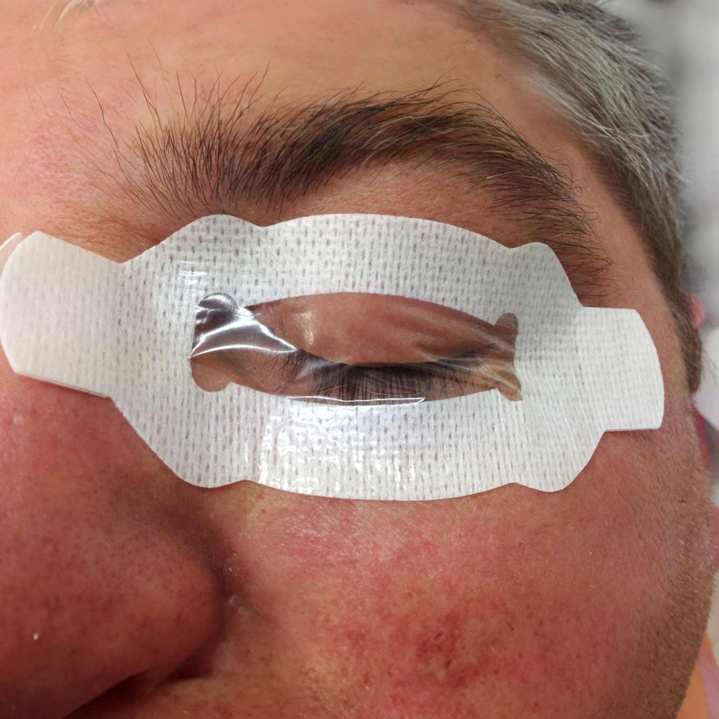 Augenschutzpflaster EyePro - sichere Anwendung bei Sedierung, einfach zu handhaben - Med-Praxisbedarf