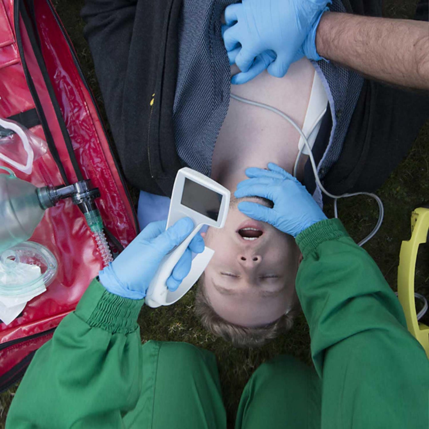 i-view Videolaryngoskop im klinischen Einsatz - Einfache Intubationshilfe mit Video - Med-Praxisbedarf