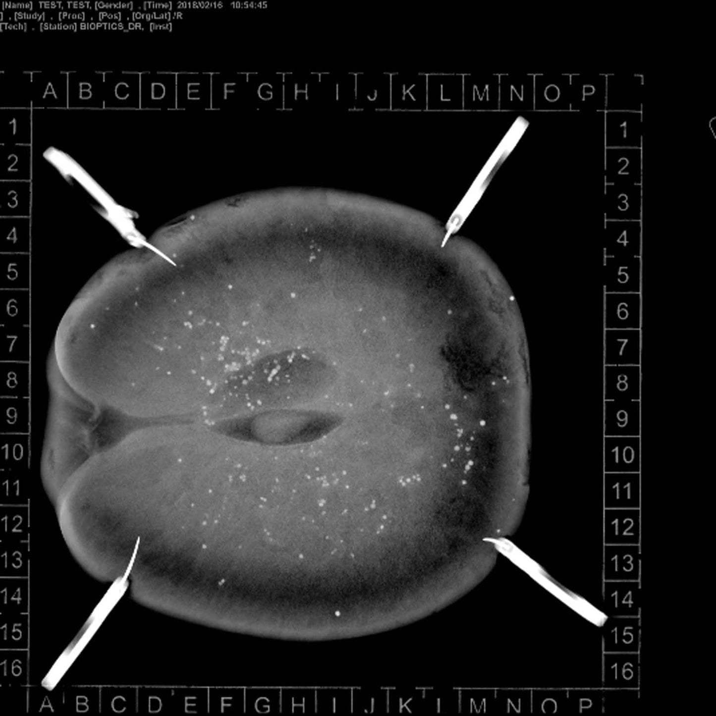 Sterile Mamma-Platte KLINITRAY - Transport- und Röntgensystem für Pathologie - Med-Praxisbedarf