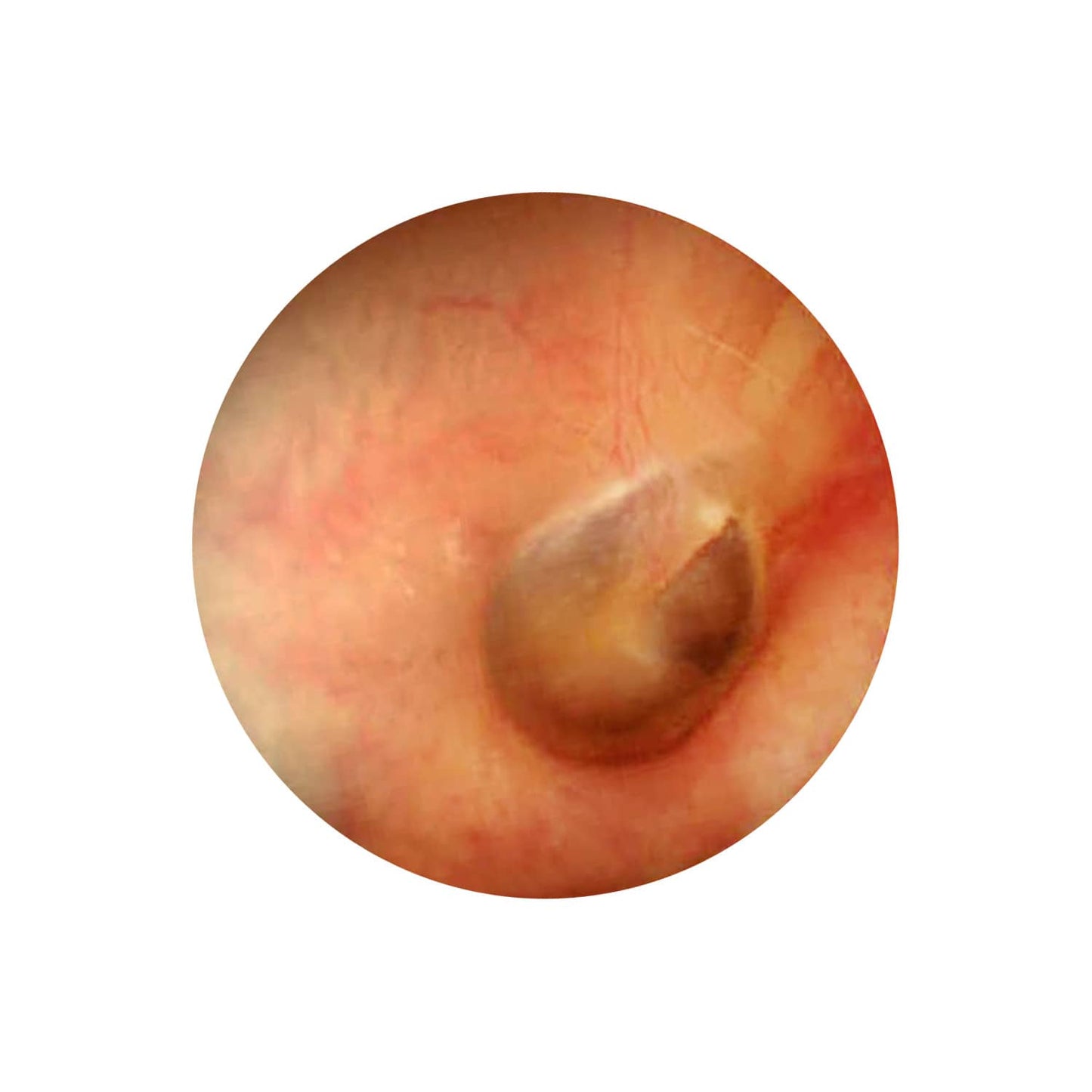 LuxaScope Auris CCT Otoskop für Gehörgangsuntersuchung - LED-Beleuchtung, von LUXAMED - Med-Praxisbedarf