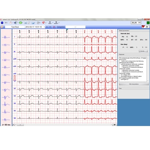 EC-12R PC-EKG in der Praxis - 12-Kanal-Gerät für präzise EKG-Aufnahmen - Med-Praxisbedarf