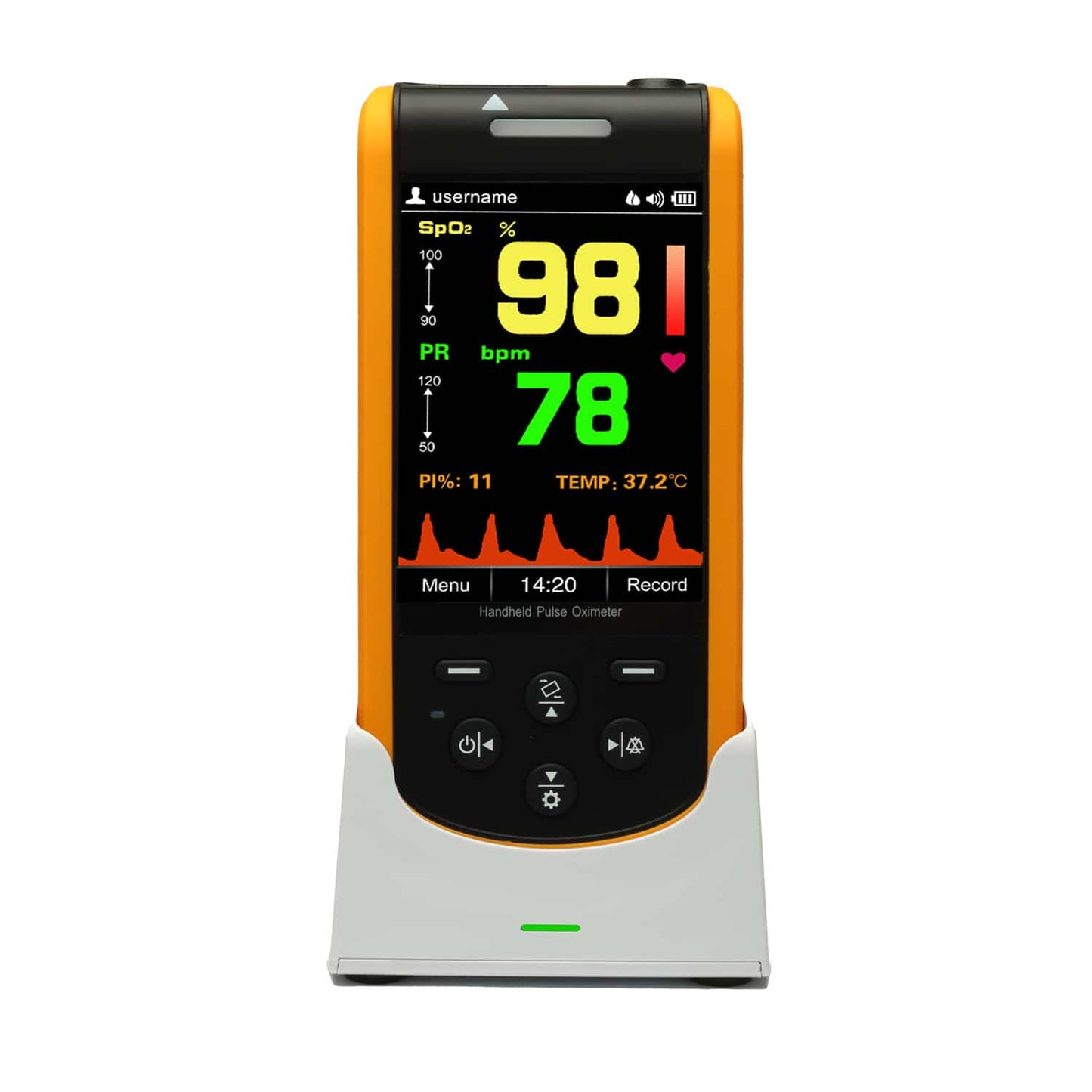 Pulsoximeter SP-20 in der Hand - kompaktes Design für den mobilen Einsatz in Praxis und Klinik - Med-Praxisbedarf
