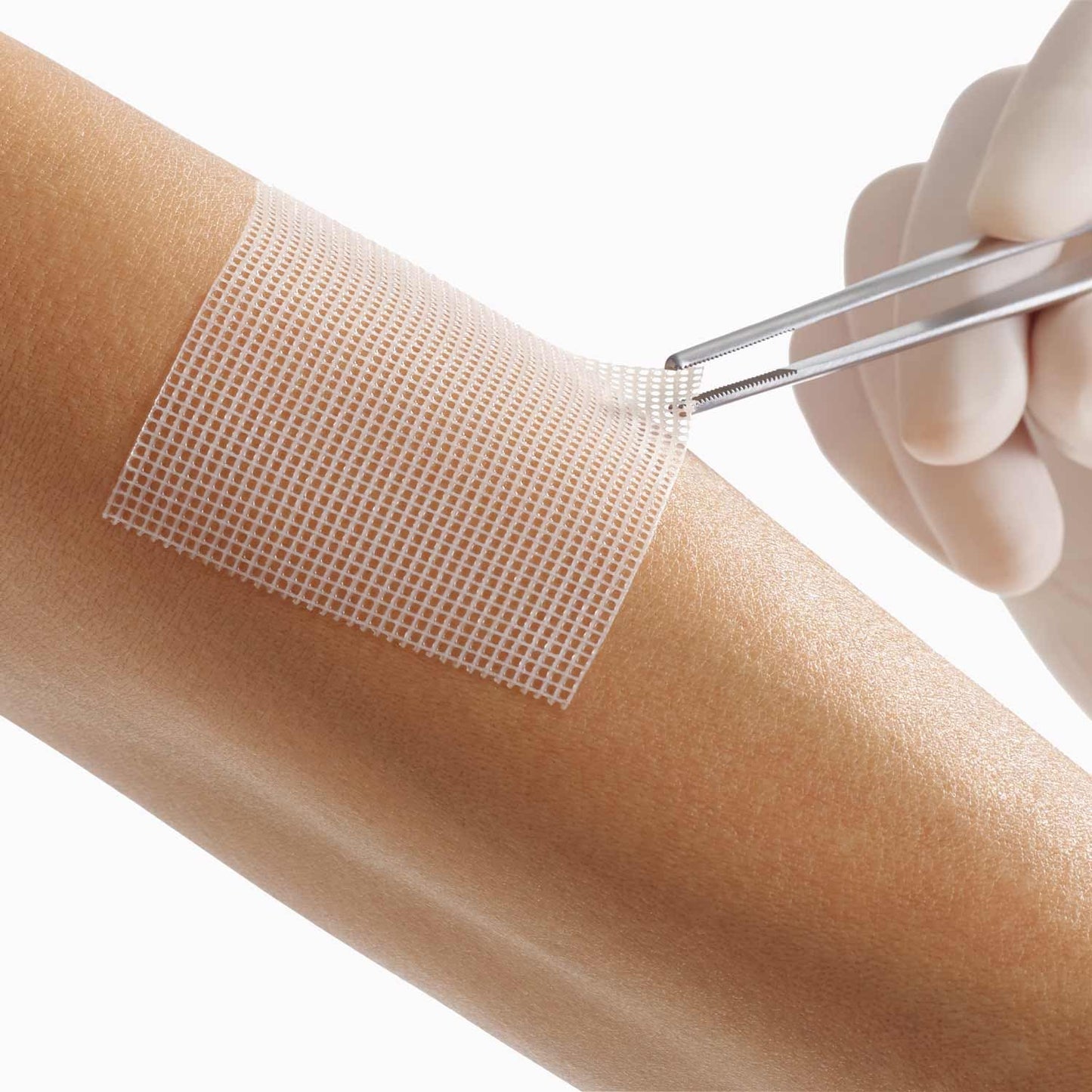 Wundkontaktnetz Lomatuell PRO von Lohmann-Rauscher - mit polymerbeschichteter Gitterstruktur - Med-Praxisbedarf