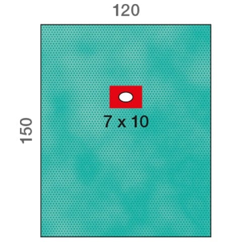 Raucodrape Lochtuch mit Inzisionsfolie - steriles OP-Abdecktuch mit selbstklebender Folie - Med-Praxisbedarf