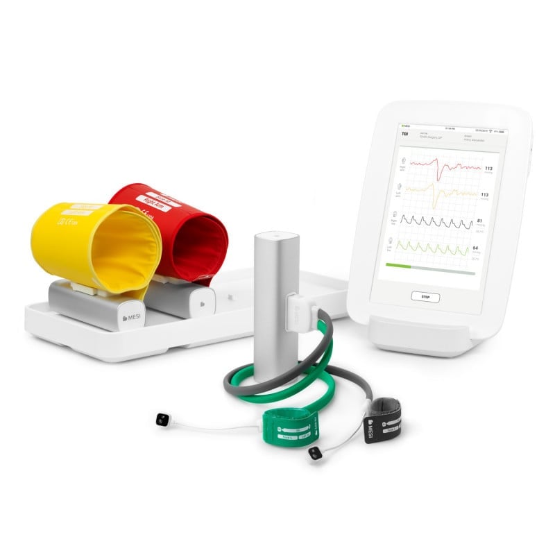 MESI mTABLET TBI System - zur Bestimmung des Zehen-Arm-Index für pAVK-Diagnostik - Med-Praxisbedarf