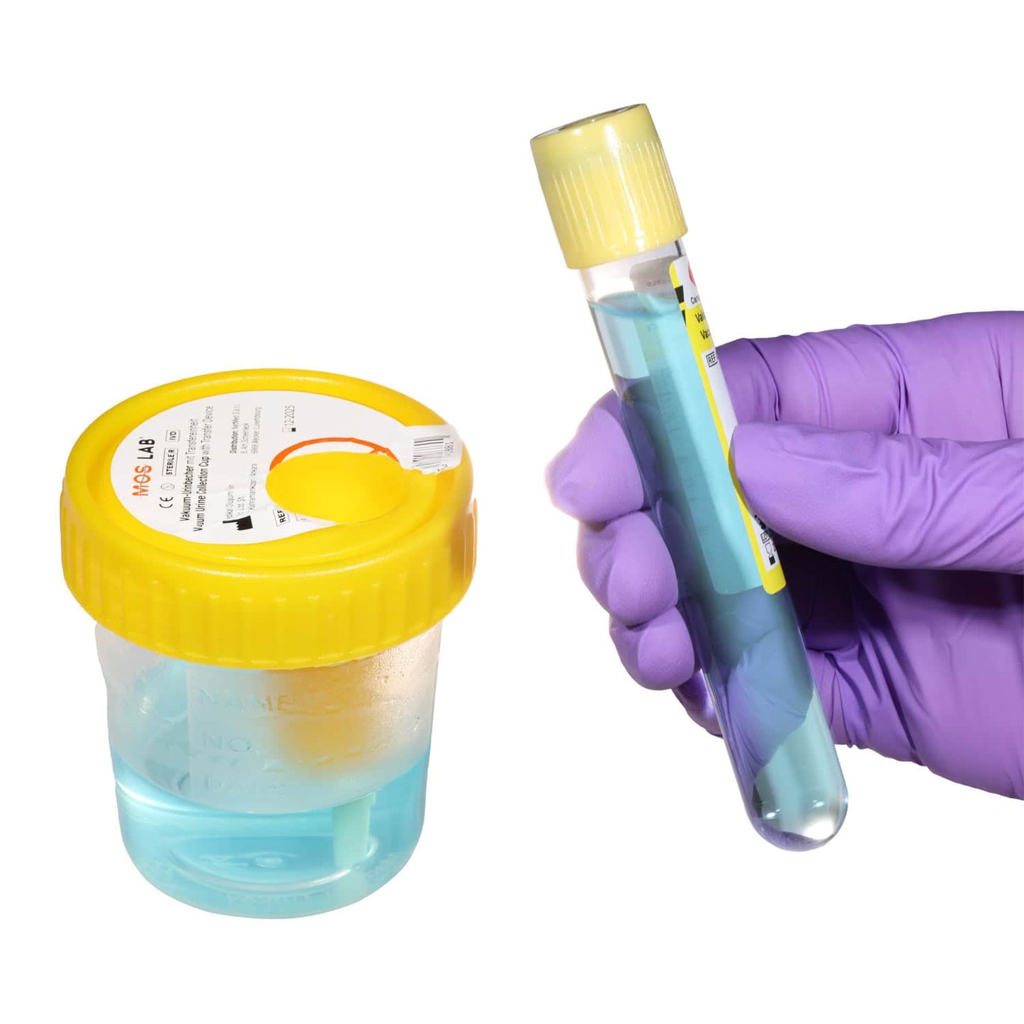 Steriler Urinbecher mit integrierter Transfereinheit - für Arztpraxen und Pflegeeinrichtungen - Med-Praxisbedarf