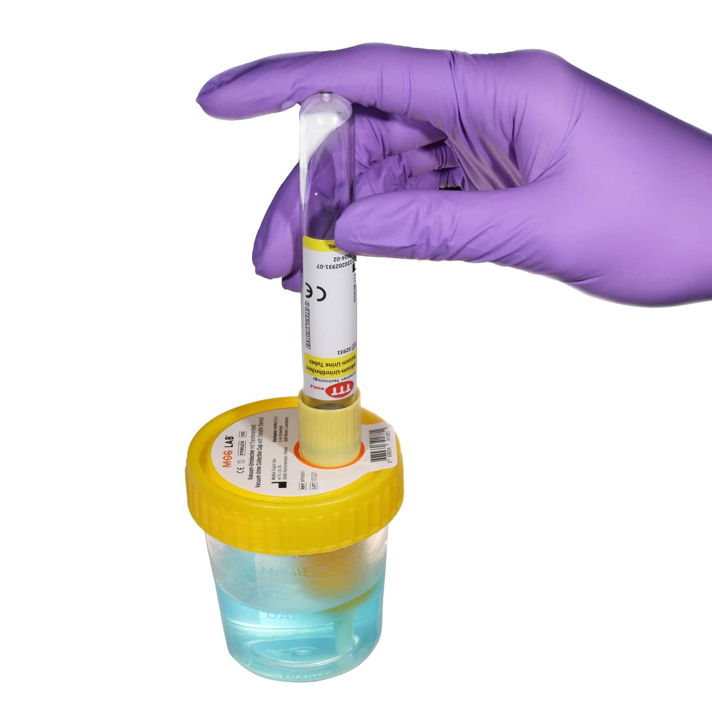 Urinprobengefäß mit Transfereinheit - steriler Becher für klinische Diagnostik - Med-Praxisbedarf