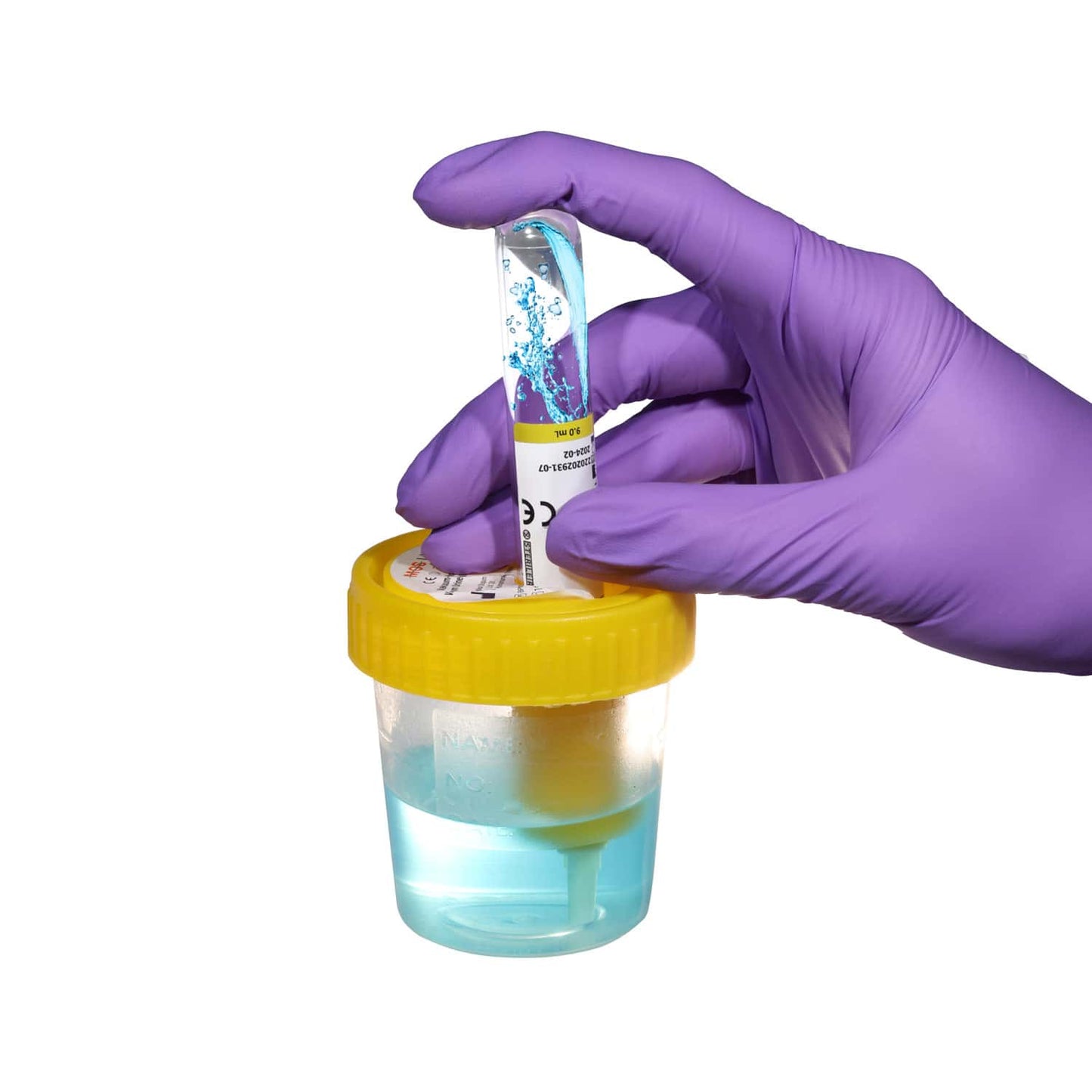 Medizinischer Urinbecher mit Transfereinheit - Einwegprodukt für Labor und Praxis - Med-Praxisbedarf
