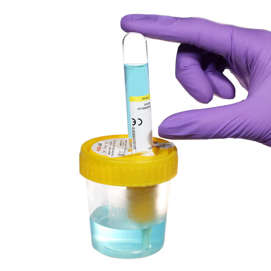 Urinbecher mit Transfereinheit MOS LAB® - steriler Einwegartikel für hygienischen Urintransfer - Med-Praxisbedarf