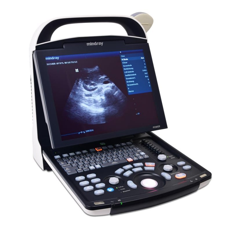 Mindray DP 10 Ultraschallgerät im Einsatz - portable Sonografie für die Diagnostik - Med-Praxisbedarf