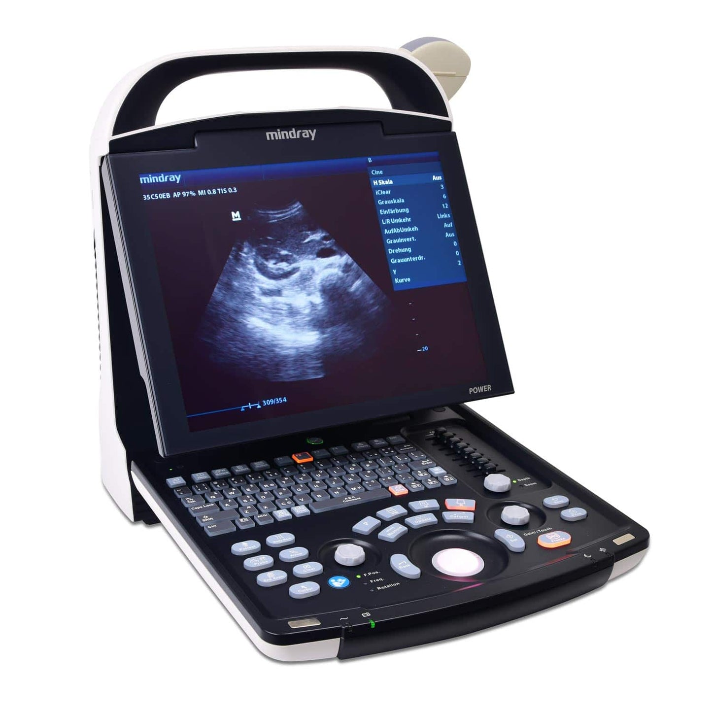 Mindray DP 10 tragbares Ultraschallgerät - Schwarz-Weiß-Gerät für Arztpraxen mit B, 2B, 4B Modi - Med-Praxisbedarf