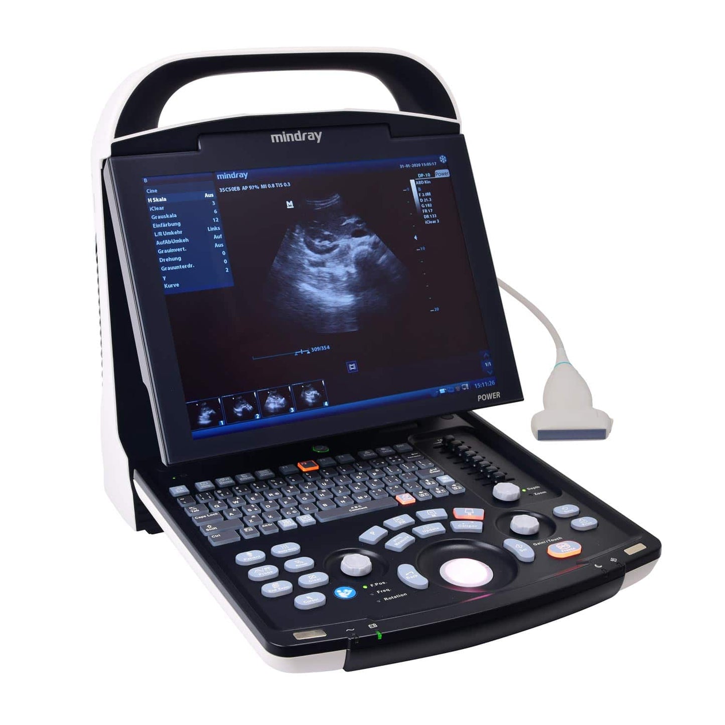 Mindray DP 30 Ultraschallgerät tragbar - mit PW-Doppler für erweiterte Diagnostik - Med-Praxisbedarf